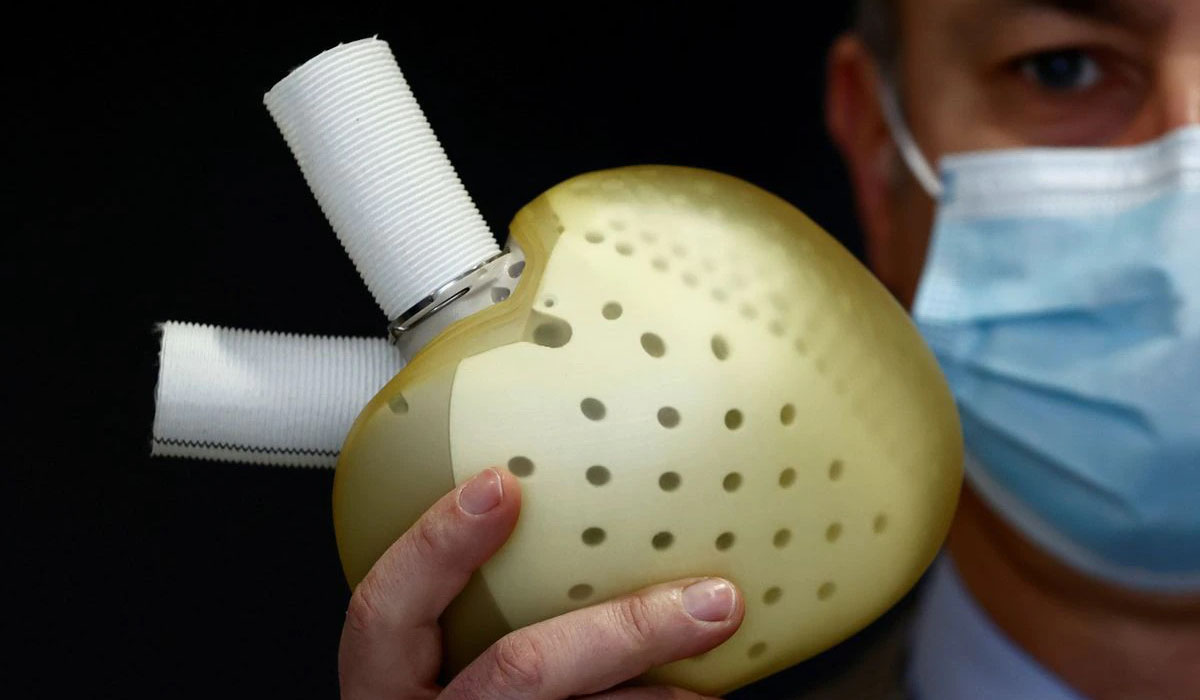 French company Carmat announces first implant of its artificial heart in a woman